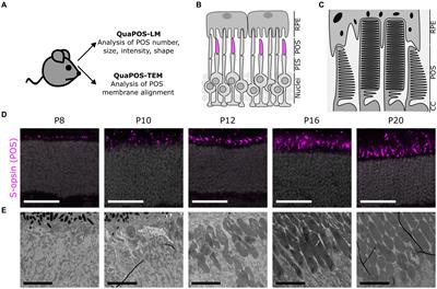 Automated quantification of photoreceptor outer segments in developing and degenerating retinas on microscopy images across scales